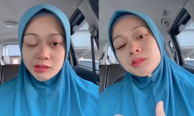 Lumpuh Sebelah Muka Faye Kusairi Muhasabah Diri