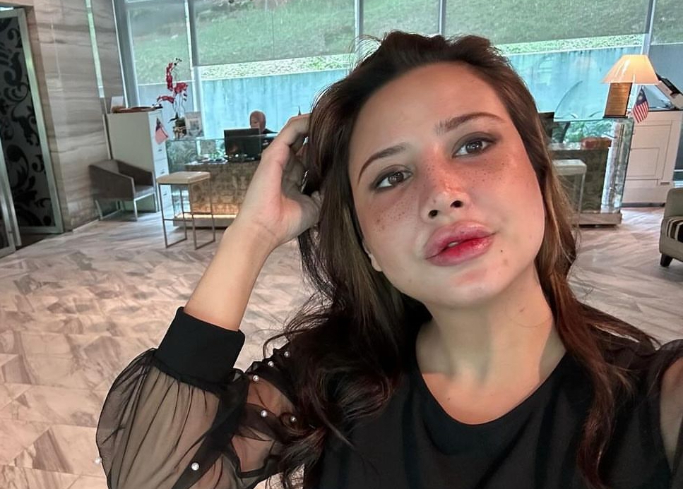 Mengaku Suntik Botox, Fathia Latiff Buat Muka Untuk Lebih Cantik