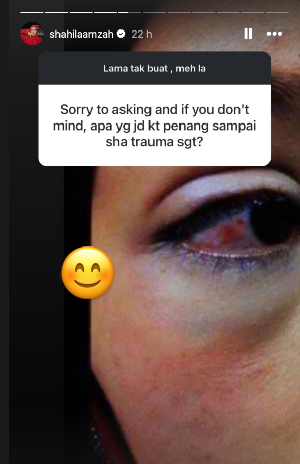 Shila Amzah Trauma Dengan Pulau Pinang, Kongsi Foto Lama Mata Lebam 5