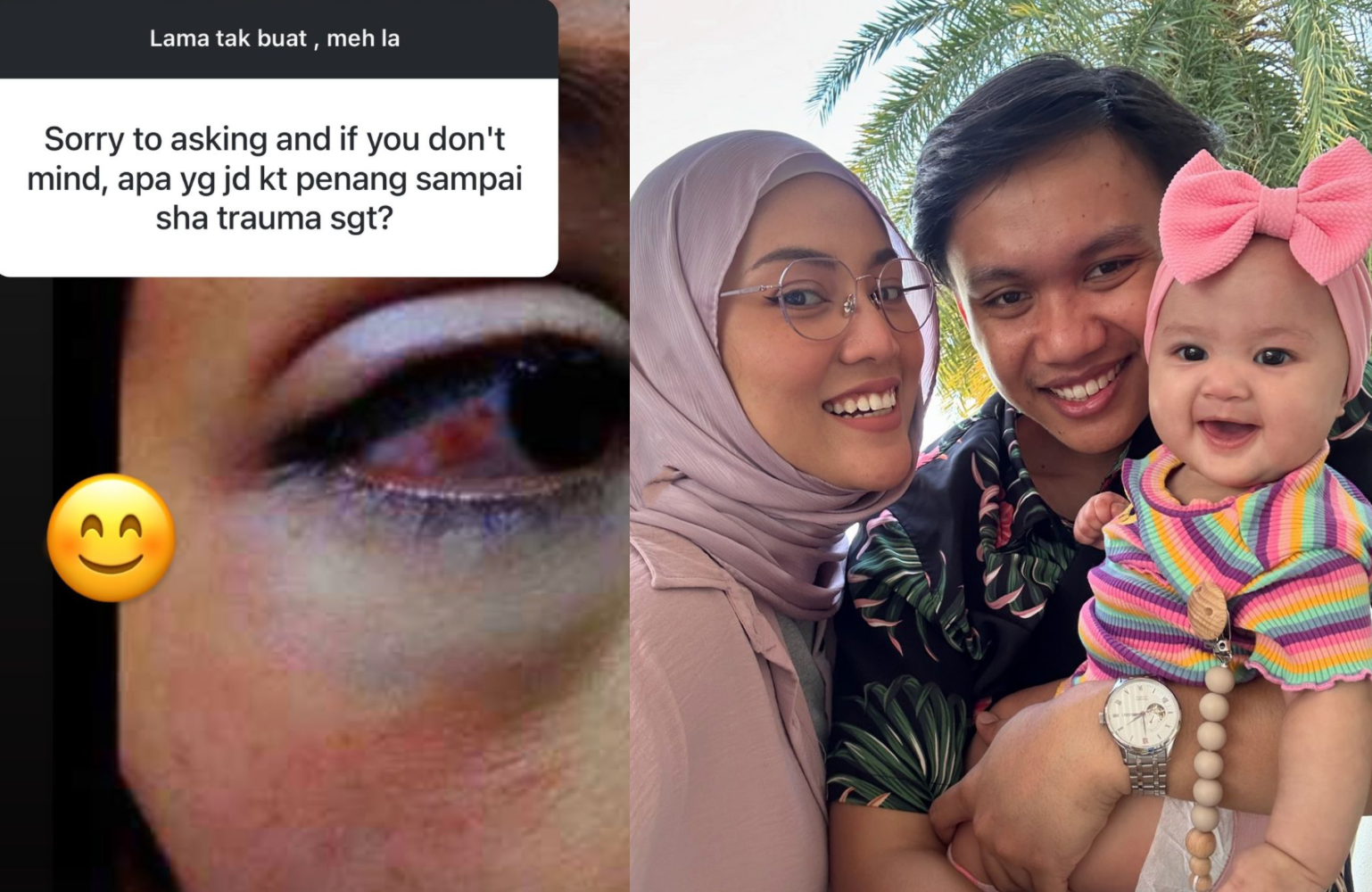 Shila Amzah Trauma Dengan Pulau Pinang, Kongsi Foto Lama Mata Lebam