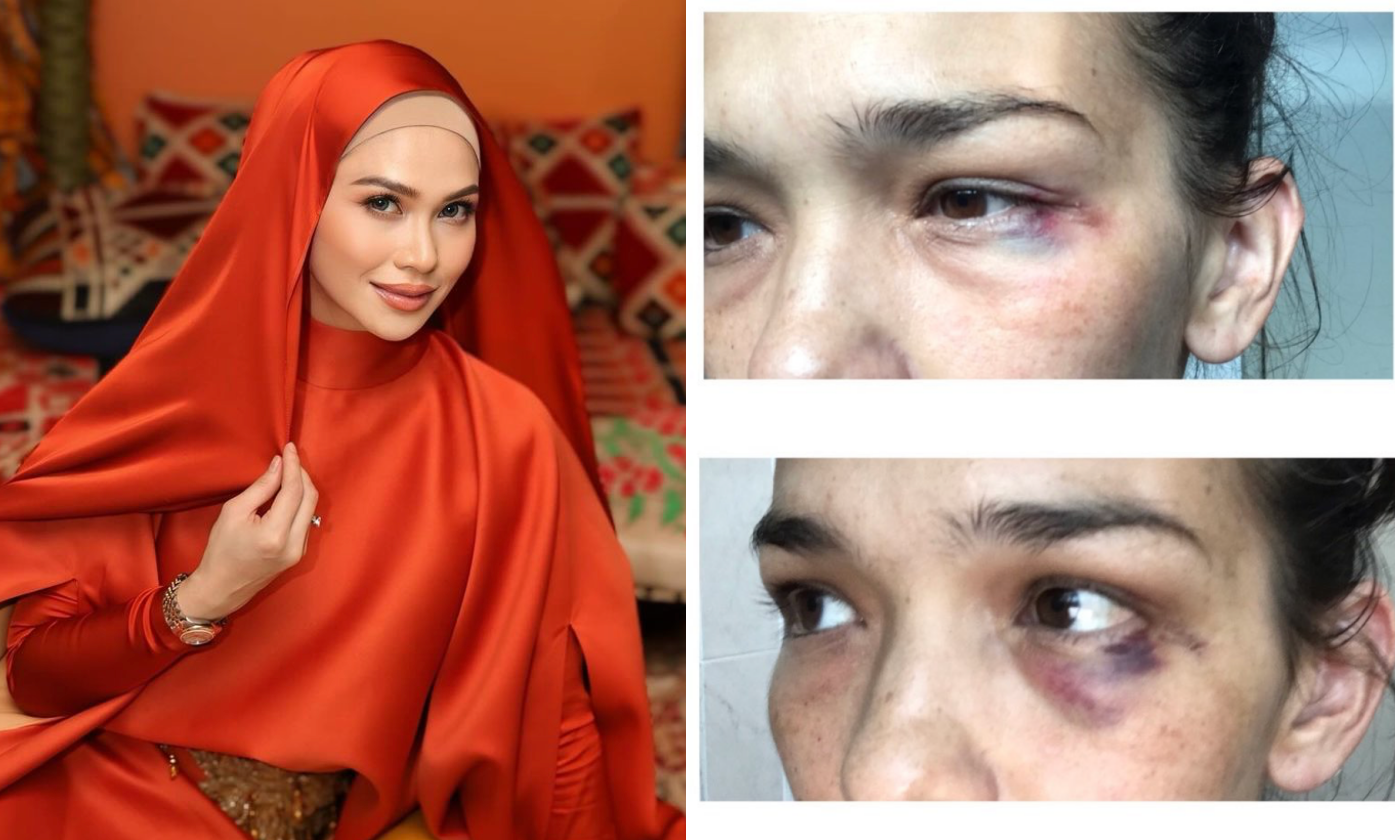 “Lelaki Sejati Tak Akan Naik Tangan Ke Wanita”